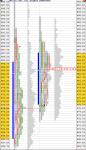 MP_March9_09_NormalDay.jpg